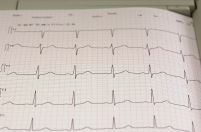 EKG & Kardiologische Tests