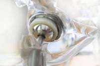 Hüftgelenkersatz Gelenkchirurgie (GZB)