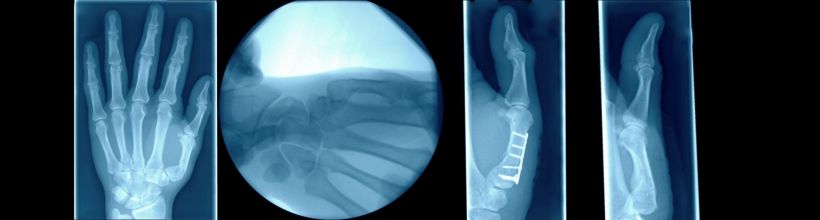 Handchirurgie Handchirurgie